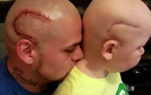 Padre Se Tatúa Cicatriz Que Le Quedó A Su Hijo Durante Lucha Contra El Cáncer 